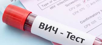 Бобруйчан приглашают пройти тестирование на ВИЧ-инфекцию